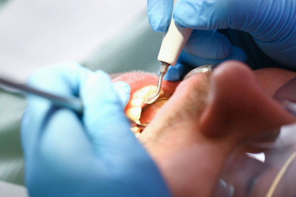Best Emergency Denture Repair in Drumright, OK