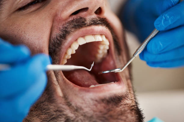 Best Emergency Treatment for Dental Infections or Abscesses in Drumright, OK