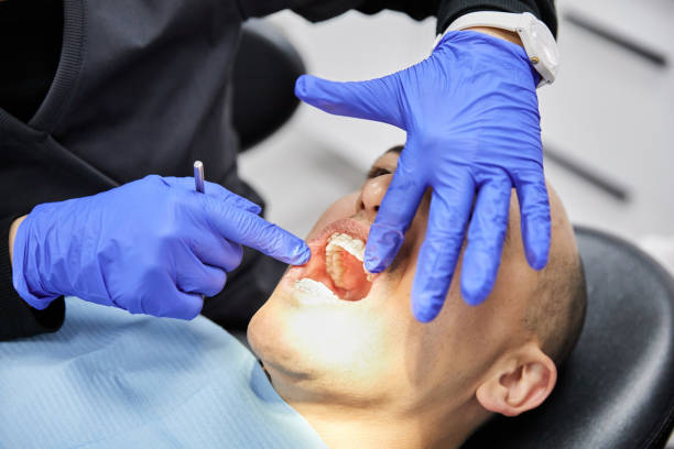 Best Emergency Tooth Extraction in Drumright, OK