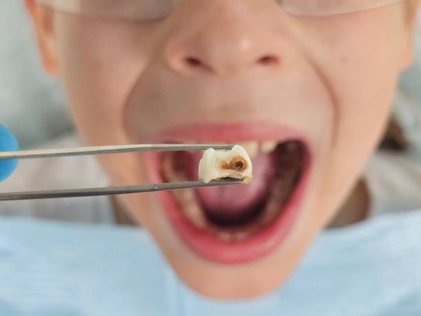 Best Emergency TMJ Treatment in Drumright, OK